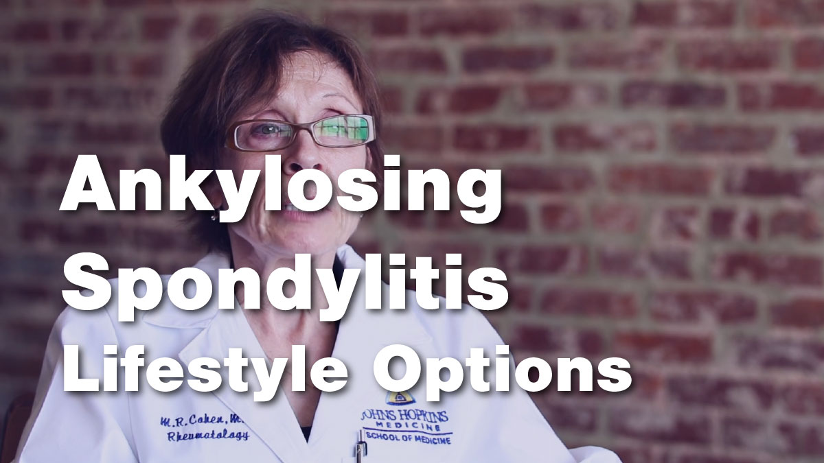 Ankylosing Spondylitis Lifestyle Options