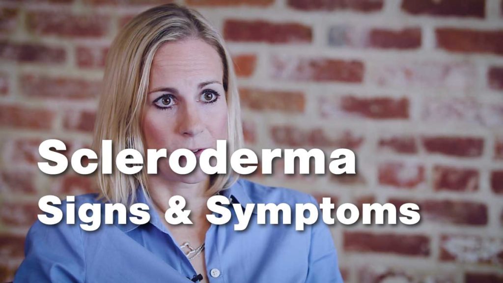 Living With Scleroderma - Johns Hopkins RheumTV