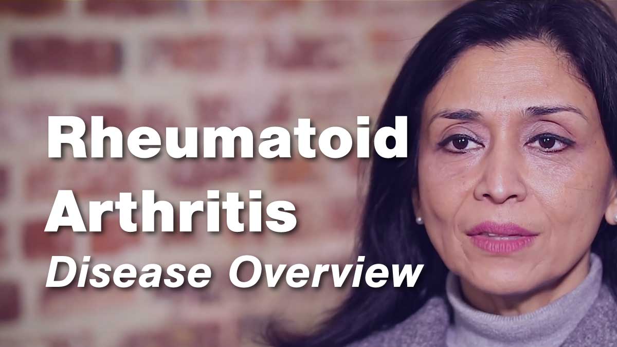 Rheumatoid Arthritis Disease Overview