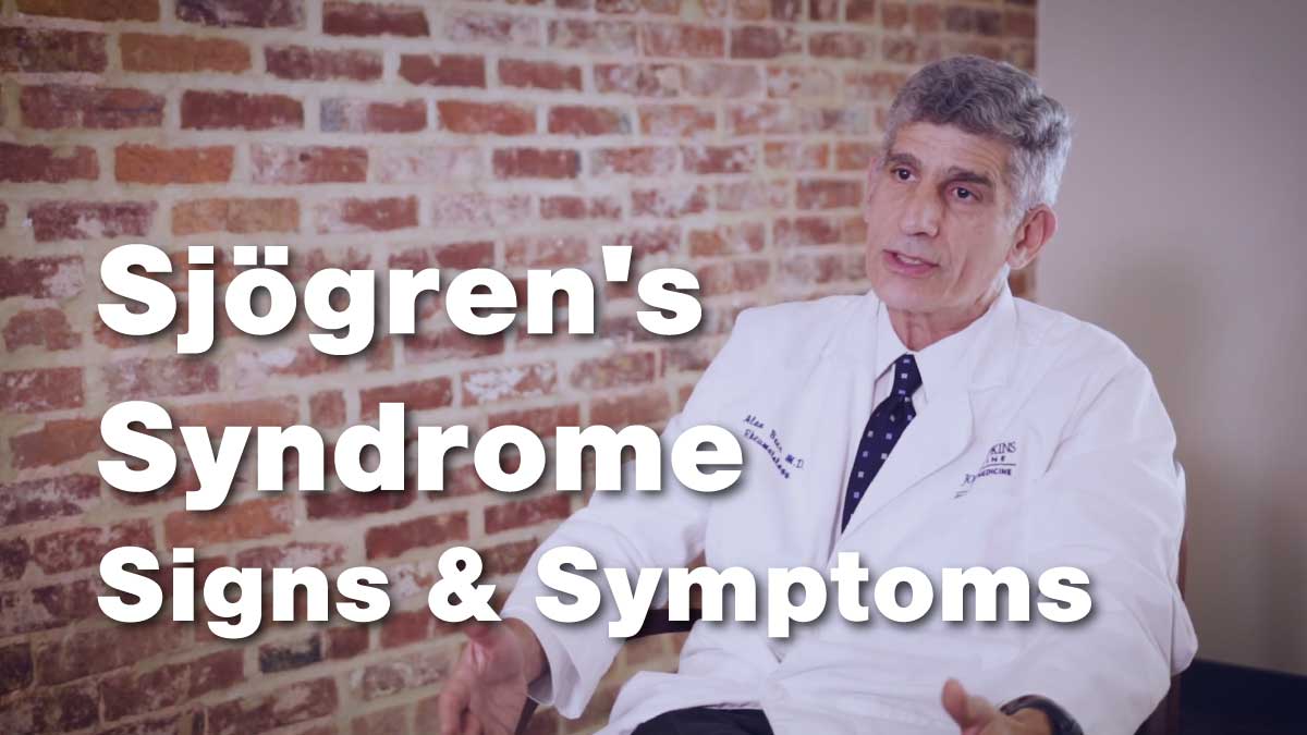 Sjögren’s Syndrome : Signs and Symptoms