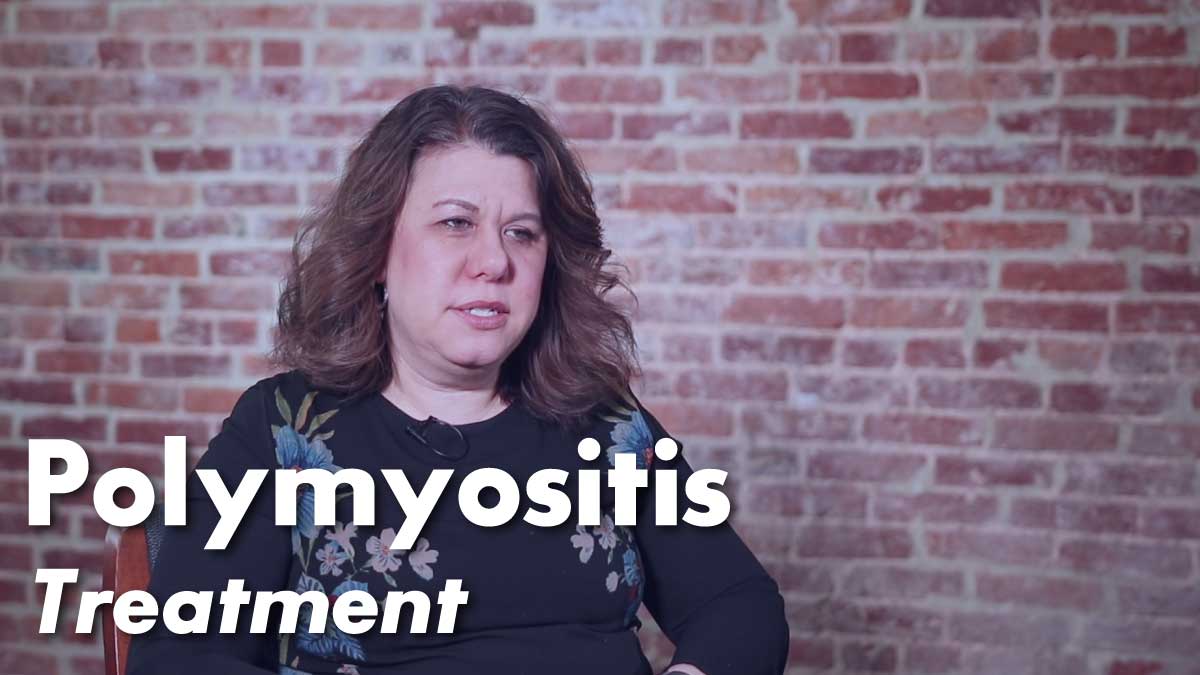 Polymyositis – Treatment